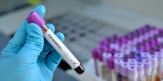 Orienta&ccedil;&otilde;es da Abepar &agrave;s escolas  associadas quanto ao coronav&iacute;rus